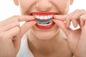 Invisalign in Fort Worth straighten smiles quickly and discreetly. Learn about these innovative aligners from the experts at Hulen Dental.